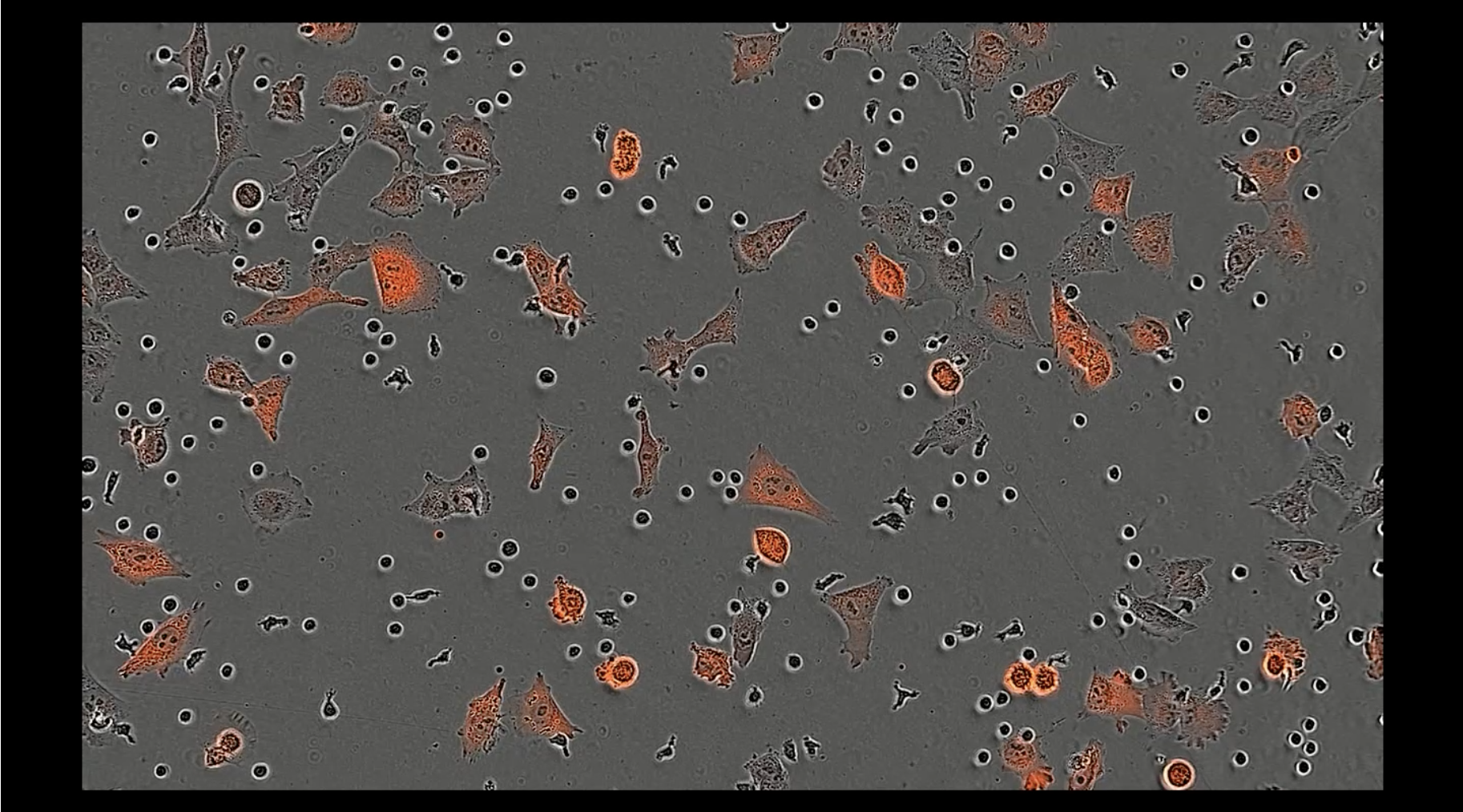 Avances en IA generativa: diseño de proteínas contra el cáncer